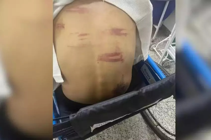Mulher é sequestrada e torturada por namorado 
