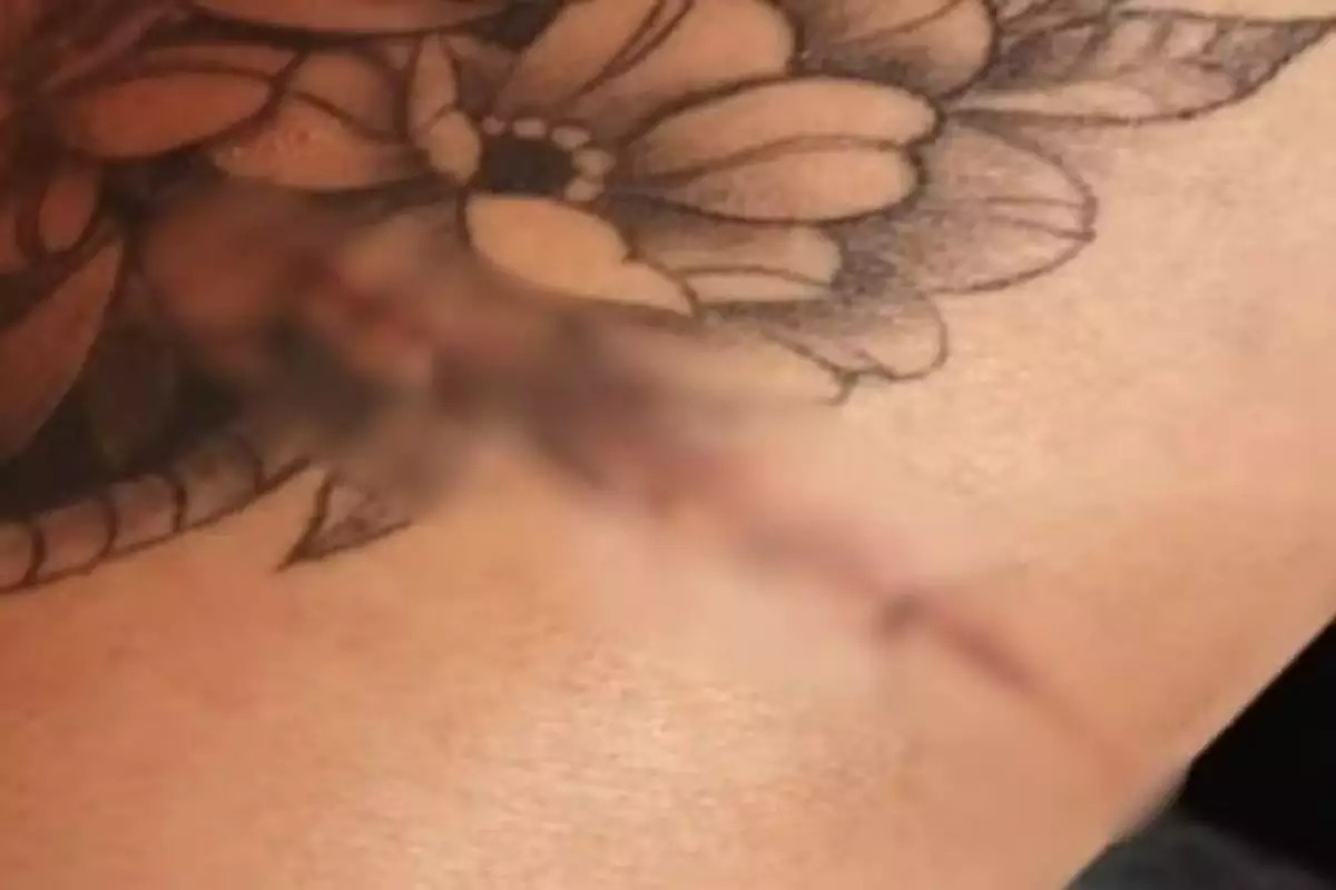 Homem arranca parte do dedo e ataca mulher com lâmina e mordidas